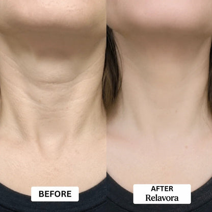 Relavora™ Micro Infusion System - Relavora