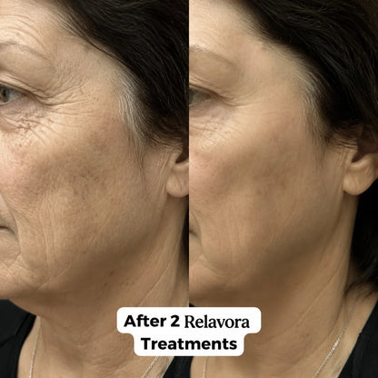 Relavora™ Micro Infusion System - Relavora