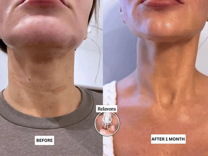 Relavora™ Micro Infusion System - Relavora