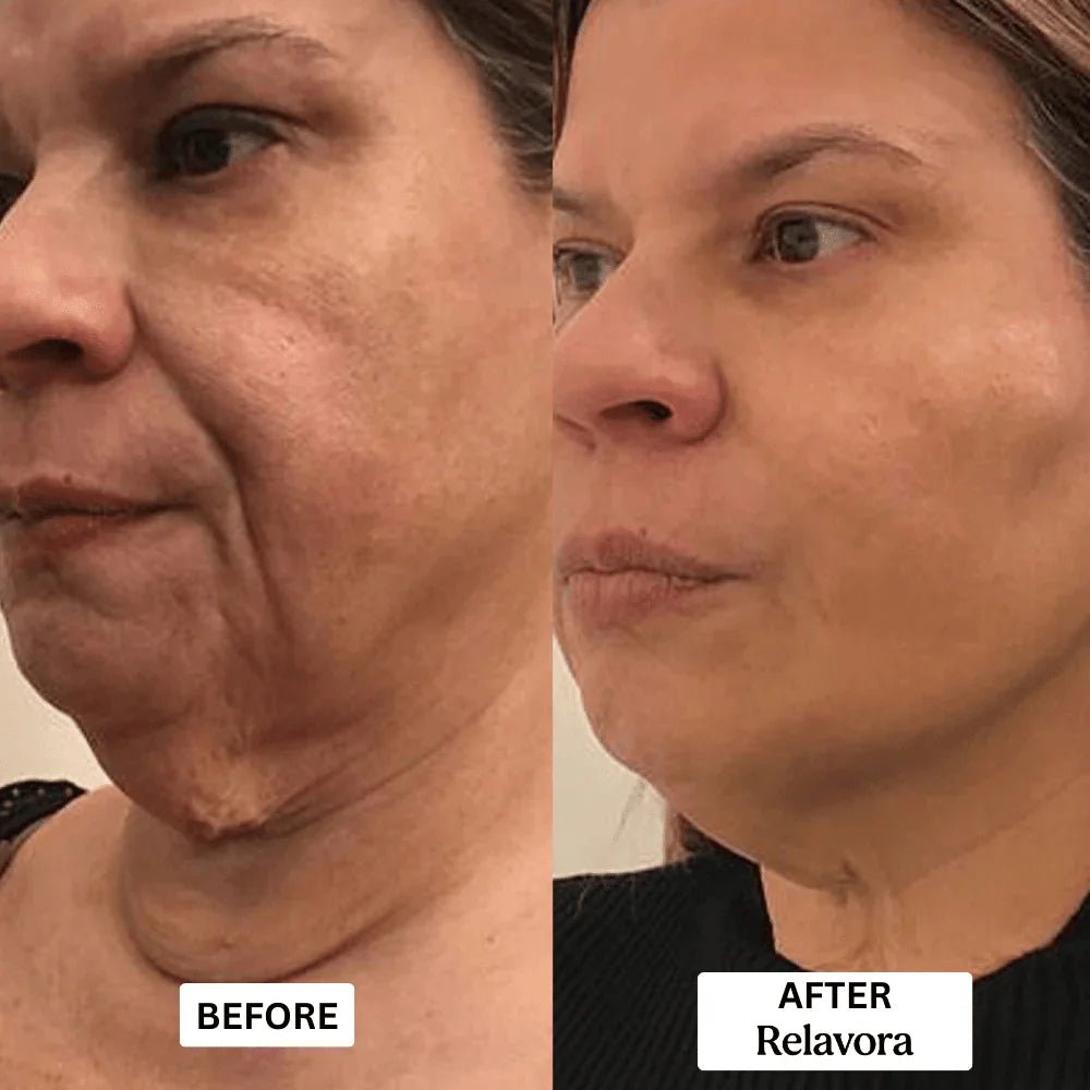 Relavora™ Micro Infusion System - Relavora