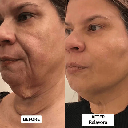 Relavora™ Micro Infusion System - Relavora