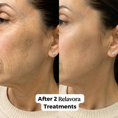 Relavora™ Micro Infusion System - Relavora