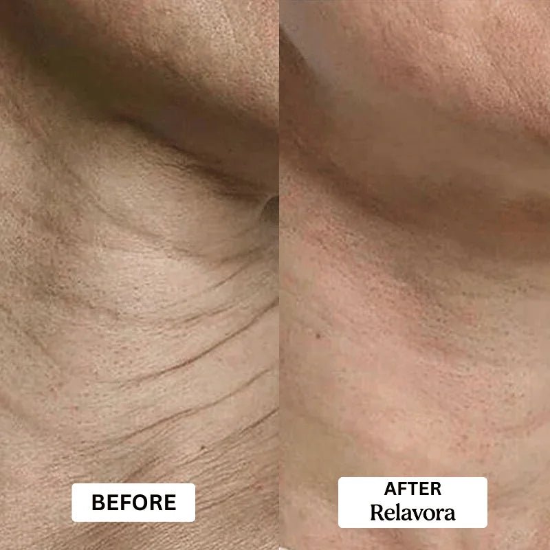 Relavora™ Micro Infusion System - Relavora