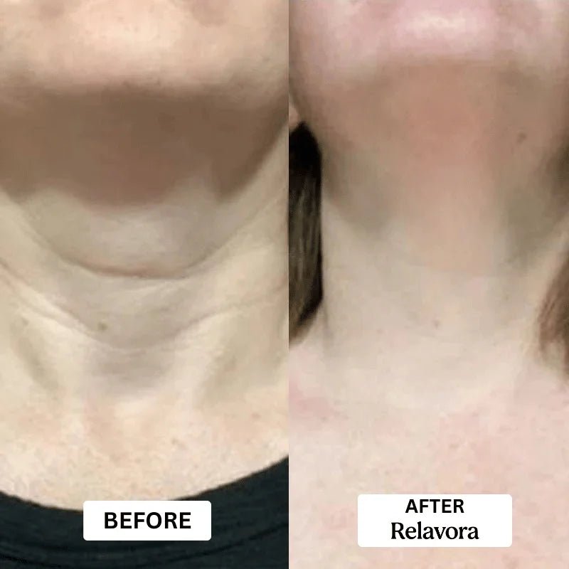 Relavora™ Micro Infusion System - Relavora