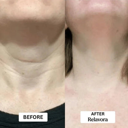 Relavora™ Micro Infusion System - Relavora