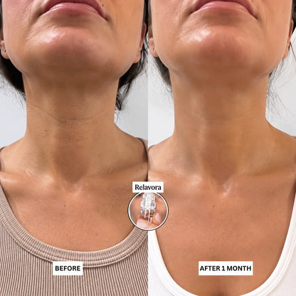 Relavora™ Micro Infusion System - Relavora