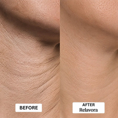 Relavora™ Micro Infusion System - Relavora