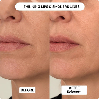 Relavora™ Micro Infusion System - Relavora