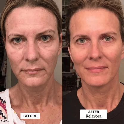 Relavora™ Micro Infusion System - Relavora